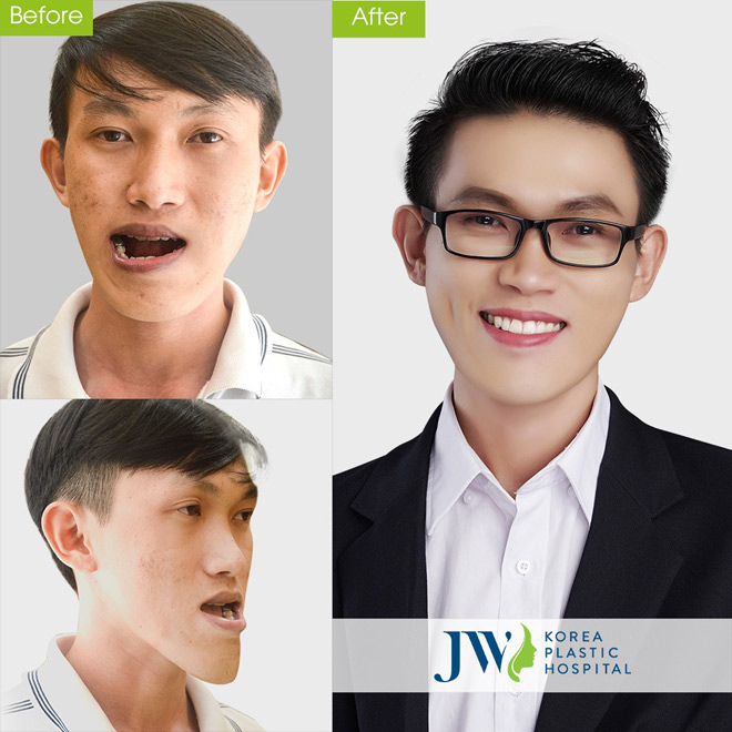 Bùng nổ công nghệ thẩm mỹ 4.0 và đánh giá của những bậc thầy thẩm mỹ - 3