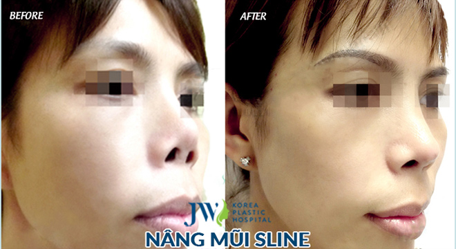 Bùng nổ công nghệ thẩm mỹ 4.0 và đánh giá của những bậc thầy thẩm mỹ - 8