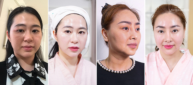 Người giàu Việt Nam làm đẹp bằng phương pháp đắt đỏ đến đâu? - 10