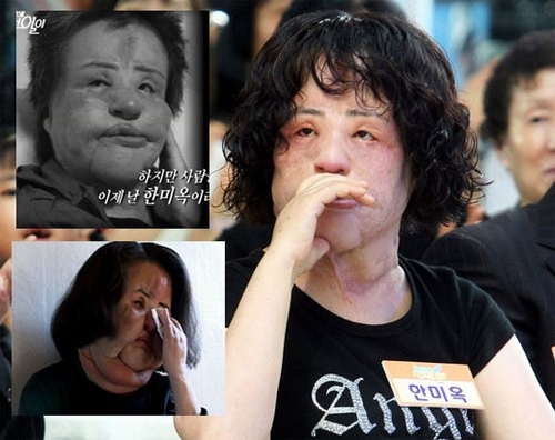 Thảm họa dao kéo sốc nhất lịch sử Hàn Quốc qua đời ở tuổi 57 - 1