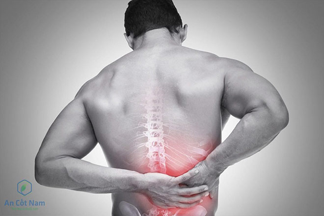 Đau thắt lưng: 5 bệnh nguy hiểm ẩn sau triệu chứng cơn đau lưng - 1