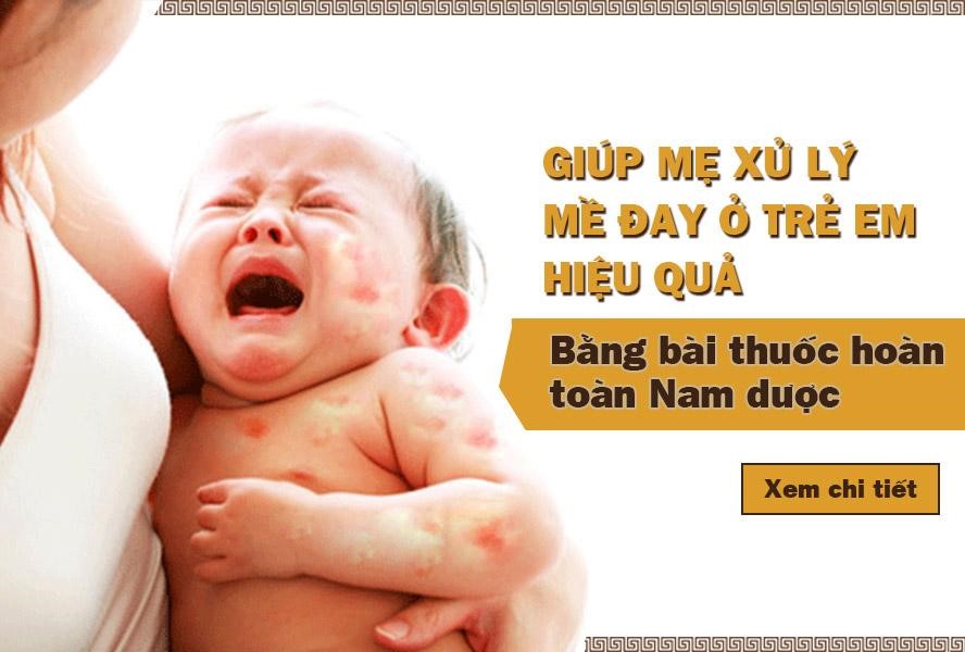 Chữa bệnh mề đay ở trẻ em: Mẹ đã biết cách xử lý đúng hay chưa? - 1