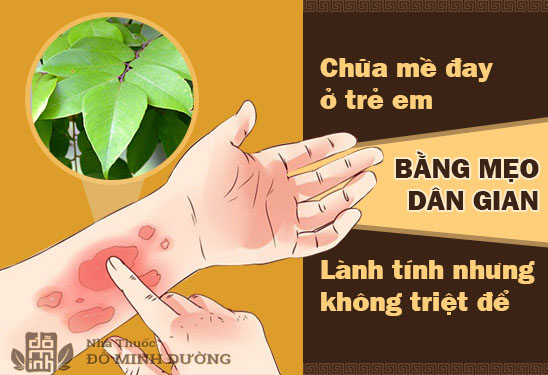 Chữa bệnh mề đay ở trẻ em: Mẹ đã biết cách xử lý đúng hay chưa? - 3