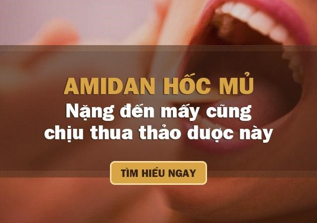 Bệnh viêm amidan hốc mủ: Cách chữa hiệu quả bằng thảo dược tự nhiên - 1