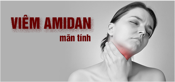 Bệnh viêm amidan hốc mủ: Cách chữa hiệu quả bằng thảo dược tự nhiên - 2