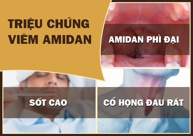 Bệnh viêm amidan hốc mủ: Cách chữa hiệu quả bằng thảo dược tự nhiên - 3