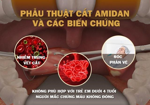Bệnh viêm amidan hốc mủ: Cách chữa hiệu quả bằng thảo dược tự nhiên - 4