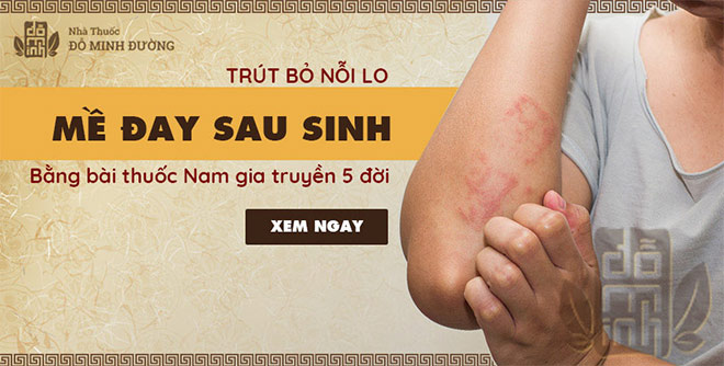 Nổi mề đay sau sinh: Dấu hiệu và cách chữa nhiều chị em tấm tắc khen hay - 1