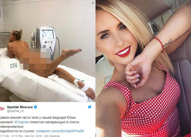 Phẫn nộ thể thao 2018: CLB tung "ảnh nóng" nữ VĐV xinh đẹp lên mạng - 1