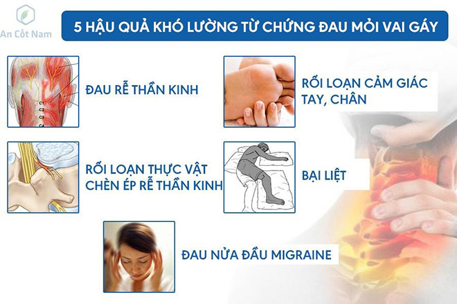 Đau mỏi vai gáy là bệnh gì? Nguyên nhân và cách chữa trị tốt nhất - 2