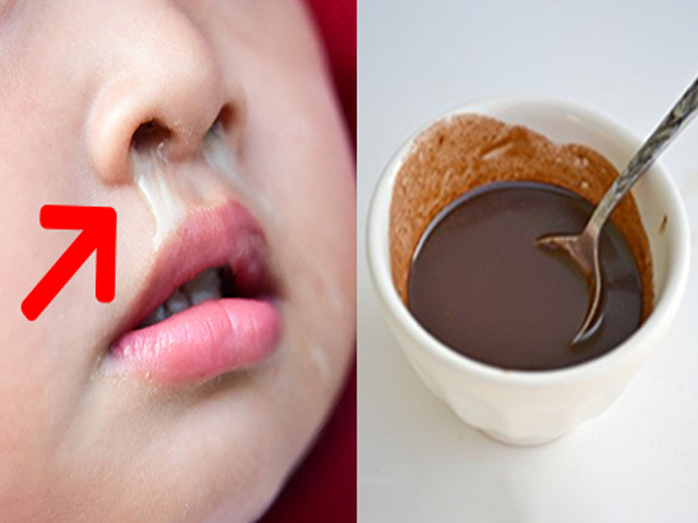 Tin tức sức khỏe - Làm cách này 2 lần/ngày, con ho đờm sổ mũi dai dẳng cũng giảm!