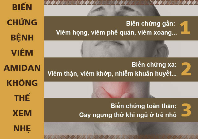 Bệnh viêm amidan: Triệu chứng và cách điều trị không cần phẫu thuật cắt bỏ - 3