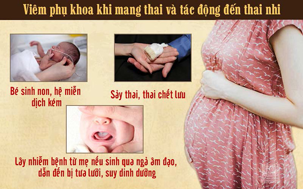 Bệnh viêm phụ khoa khi mang thai: Dấu hiệu và cách điều trị tốt nhất - 3