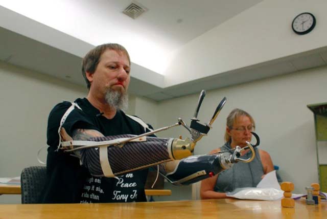 Để chó liếm, người đàn ông phải cắt cụt tứ chi - 3