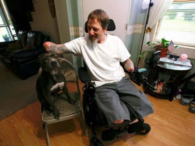 Sức khỏe đời sống - Để chó liếm, người đàn ông phải cắt cụt tứ chi