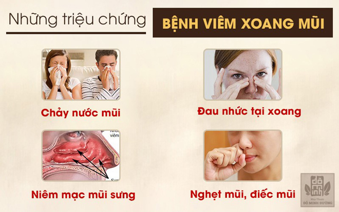 Bệnh viêm xoang mũi là gì? Nhận biết triệu chứng và cách chữa hiệu quả - 2