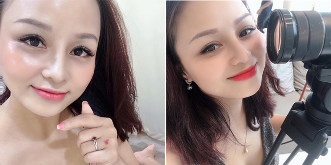 Chị rạng rỡ khoe da mộc sau khi điều trị nám thành công