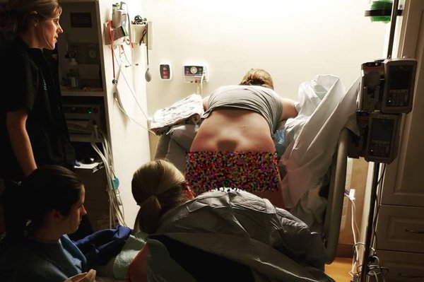 Bức ảnh chụp rõ phần xương cụt đang nhô ra của người phụ nữ khi sinh con gây kinh ngạc.