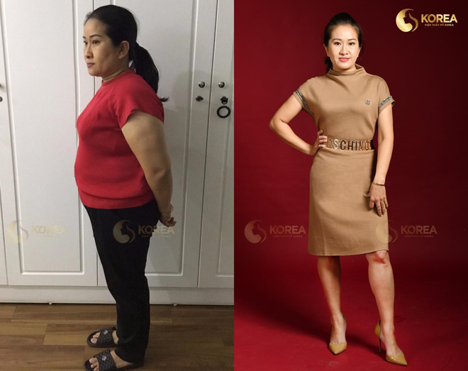 Chị Hồ Nguyên Hải (Lạng Sơn) giảm 18kg nhờ CN giảm béo Max Thin Nanomax, bất chấp cơ địa mỡ lỳ, rắn chắc, hơn 20 năm giảm mỡ bất thành.