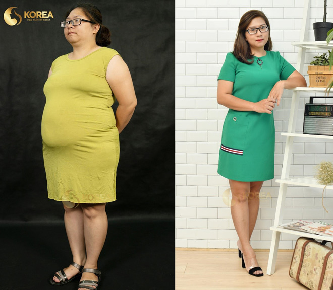 Nữ giám đốc kinh doanh Nguyễn Thị Thanh (Hà Nội) giảm 17kg nhờ công nghệ giảm béo Max Thin Nanomax.