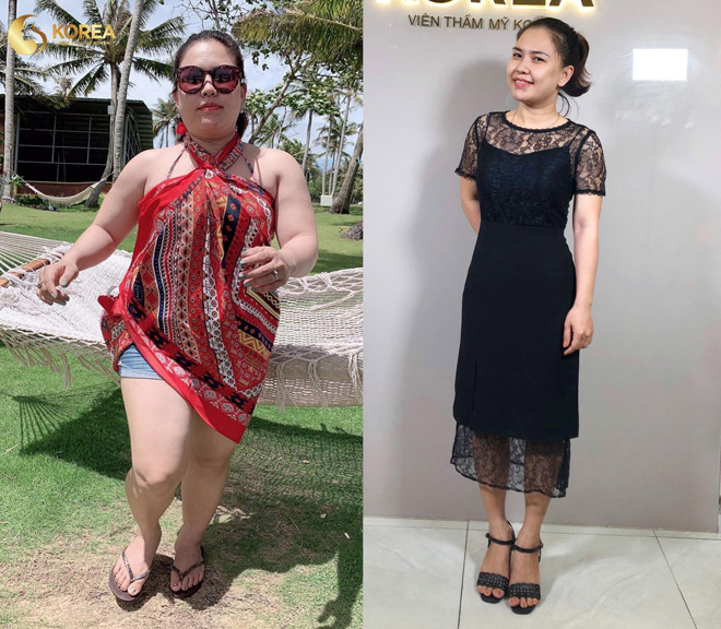 Sự lột xác của chị Nguyễn Thị Khánh Chân giảm 8kg nhờ CN giảm béo Max Thin Nanomax. Chị đã trở lại vóc dáng thời con gái, cuộc sống của chị cũng thay đổi tích cực theo.