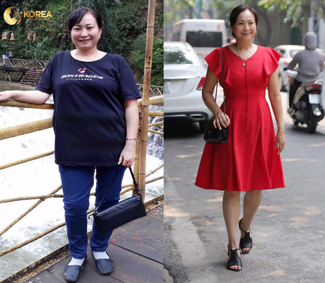 Chị Minh (Sóc Sơn, Hà Nội) giảm 10kg nhờ CN giảm béo Max Thin Nanomax, thoát khỏi chứng thoát vị đĩa đệm.