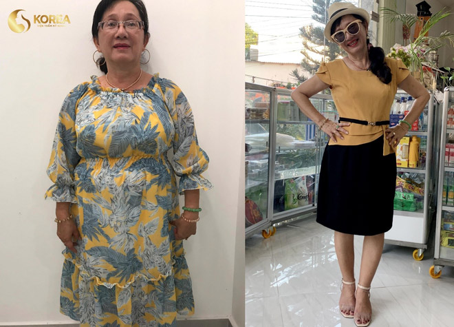 Nhờ công nghệ giảm béo Max Thin Nanomax, cô Hạnh (Khánh Hòa, Nha Trang) giảm 10kg. Cô đã tìm lại được vóc dáng thời con gái, đồng thời, cô cũng không còn tình trạng bị nấc và hay bị ngất nữa.