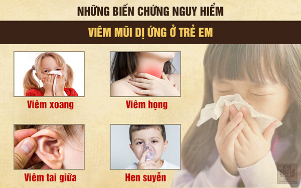 Bệnh viêm mũi dị ứng ở trẻ em và cách điều trị không kháng sinh - 2