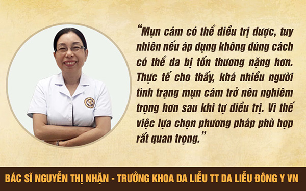 Mụn cám là gì và cách trị hiệu quả lấy lại làn da mịn màng, trắng sáng - 2