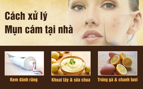 Mụn cám là gì và cách trị hiệu quả lấy lại làn da mịn màng, trắng sáng - 3
