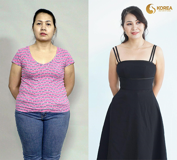 Những ca giảm béo “kinh điển” biến đổi ngoại hình - 3