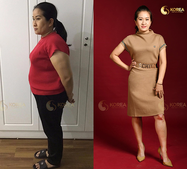 Những ca giảm béo “kinh điển” biến đổi ngoại hình - 5