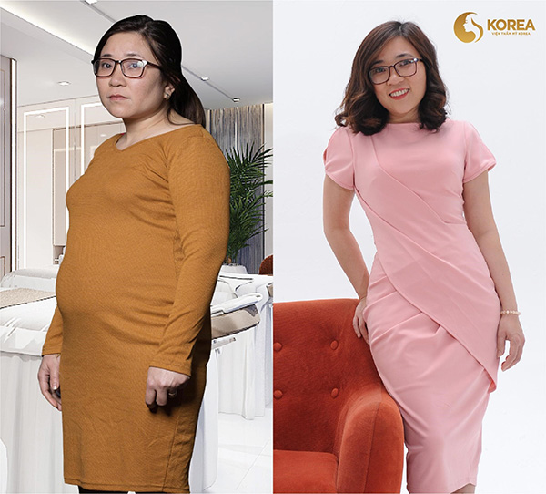 Những ca giảm béo “kinh điển” biến đổi ngoại hình - 6