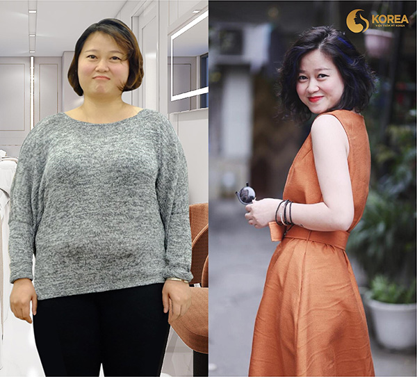 Những ca giảm béo “kinh điển” biến đổi ngoại hình - 7