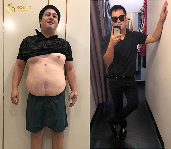 Những ca giảm béo “kinh điển” biến đổi ngoại hình - 8