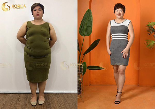 Những ca giảm béo “kinh điển” biến đổi ngoại hình - 9