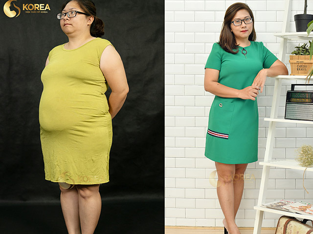 Làm đẹp - Những ca giảm béo “kinh điển” biến đổi ngoại hình