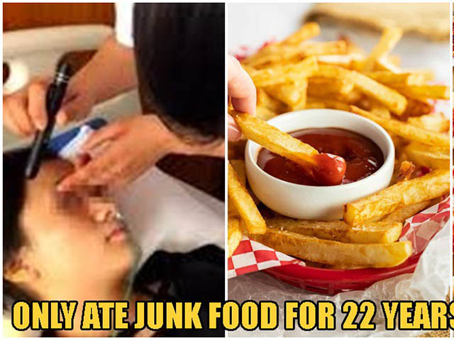 Sức khỏe đời sống - Cô gái xinh đẹp gần như bị mù vì không ăn rau, trái cây suốt 22 năm