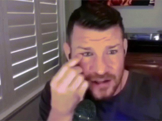 Phi thường - kỳ quặc - Rùng mình cựu vô địch UFC tự móc mắt ngay trong lúc phỏng vấn