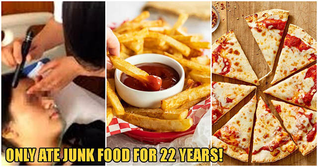 Cô gái xinh đẹp gần như bị mù vì không ăn rau, trái cây suốt 22 năm - 2