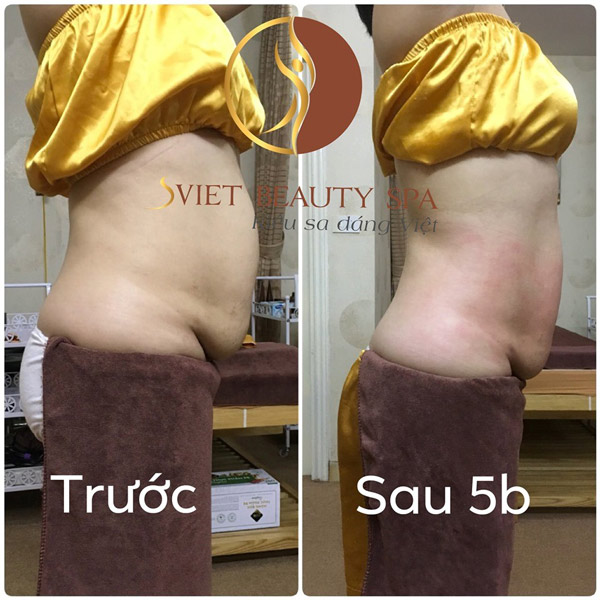 Sviet Beauty – trung tâm đào tạo Spa điêu khắc giảm béo chuyên nghiệp - 4