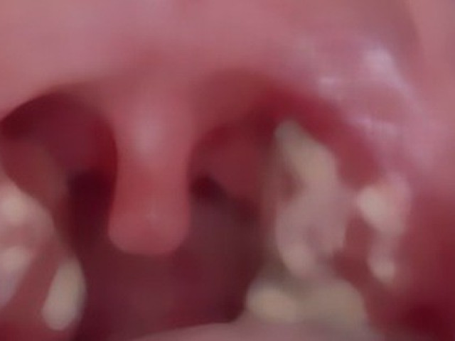 Sức khỏe đời sống - Buông thả tại quán karaoke, nam thanh niên thấy dấu hiệu bất thường ở "của quý"