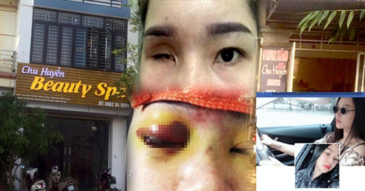 Tin tức trong ngày - Thẩm mỹ viện Chu Huyền lên tiếng vụ nâng mũi khiến khách mù mắt