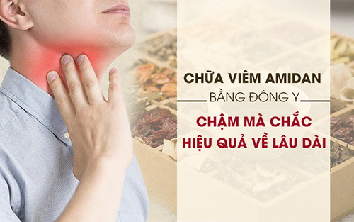 Bệnh viêm amidan cấp: Chuyên gia chỉ rõ triệu chứng và cách điều trị không tái phát - 1