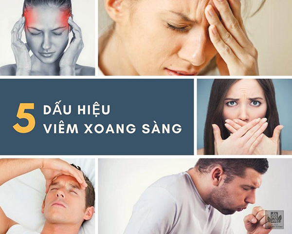 Cách nhận biêt bệnh viêm xoang Cách nhận biêt bệnh viêm xoang