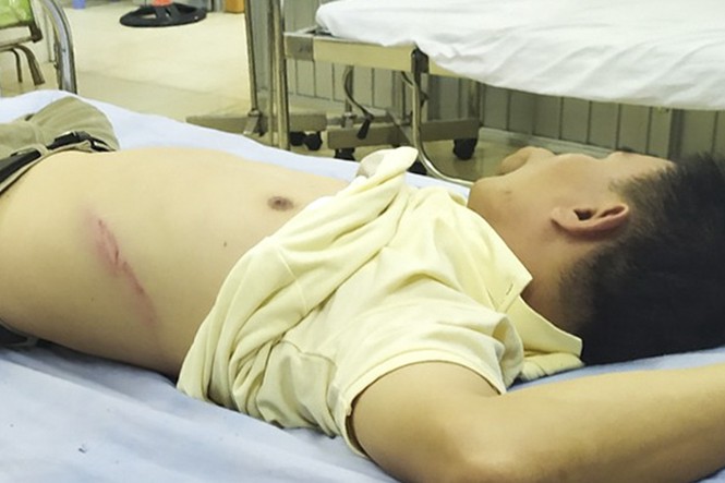 Ông Trung đang phải điều trị tại bệnh viện vì bị côn đồ hành hung. Ảnh CTV