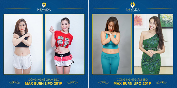 Diễn viên Trang Moon và MC Vân Hugo “lột xác” thành công nhờ Max Burn Lipo