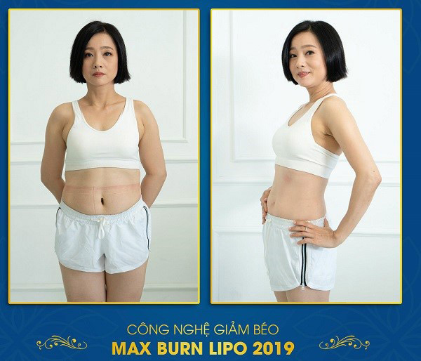 NSƯT Mỹ Duyên trước và sau khi sử dụng Max Burn Lipo