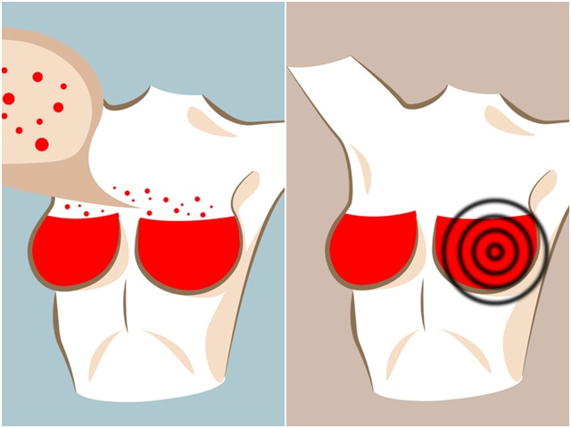 Sức khỏe đời sống - Có 6 dấu hiệu này ở ngực, nguy cơ bạn mắc các bệnh nguy hiểm rất cao