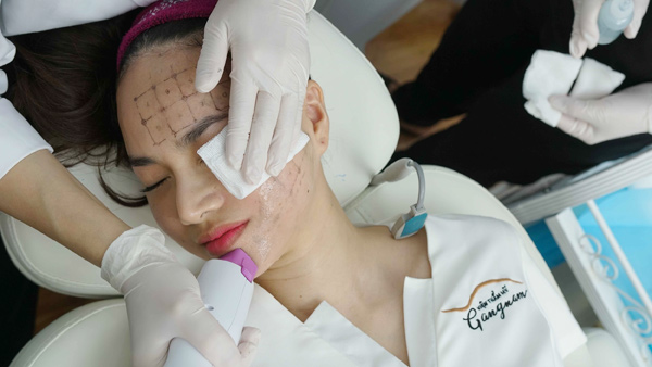 Thermage FLX cũng là phương pháp xóa nhăn được nhiều chị em lựa chọn, trong đó có diễn viên Đinh Ngọc Diệp